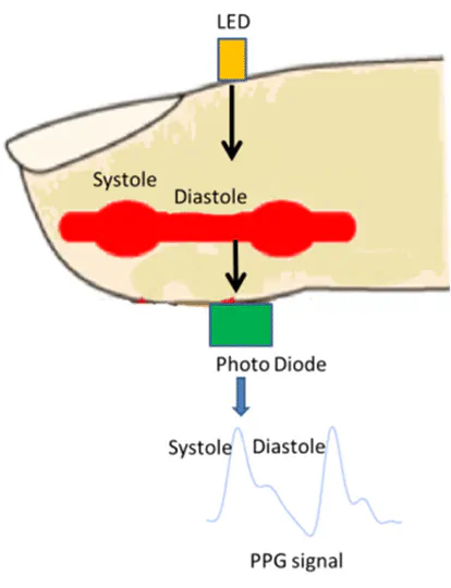 Developing a Synthetic Photoplethysmography Generative Adversarial Network Wave Generation Model using MIMIC-IV Waveform Dataset