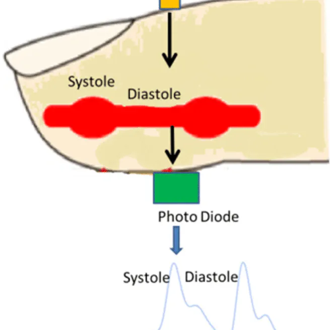 Developing a Synthetic Photoplethysmography Generative Adversarial Network Wave Generation Model using MIMIC-IV Waveform Dataset